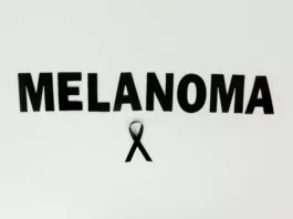 Mucosal melanoma