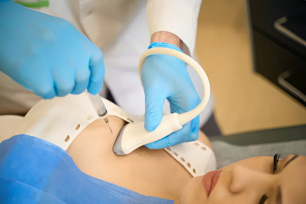 Doctor performing Ultrasound assisted Needle biopsy of breast