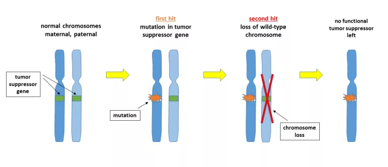 Two-Hit Hypothesis for Progression of Retinoblastoma